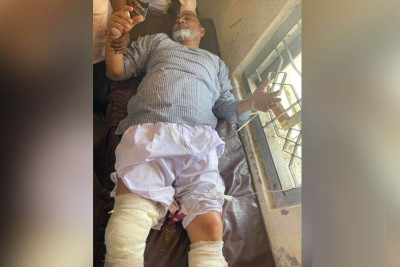 কোম্পানীগঞ্জ আ'লীগের সাধারণ সম্পাদক গুলিবিদ্ধ, পা ভেঙে দিয়েছে সন্ত্রাসীরা কোম্পানীগঞ্জ আ'লীগের সাধারণ সম্পাদক গুলিবিদ্ধ, পা ভেঙে দিয়েছে সন্ত্রাসীরা