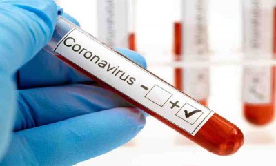 করোনায় আরও ৩৮ জনের মৃত্যু, শনাক্ত ১০২৮