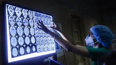দেশে দুজনের শরীরে ‘ব্ল্যাক ফাঙ্গাস’ শনাক্ত দেশে দুজনের শরীরে ‘ব্ল্যাক ফাঙ্গাস’ শনাক্ত